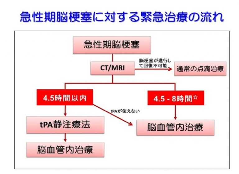 国産原料100% 脳神経外科 急性期脳梗塞に対する血管内治療 -電子版付 